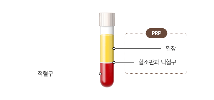 혈액 원심분리 후
